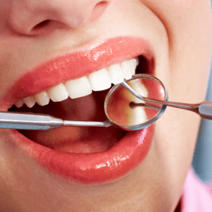 Dental Fillings in Milwaukee, WI